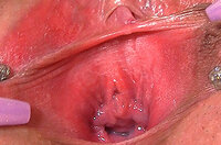 Pussy My Gape Login Account s1